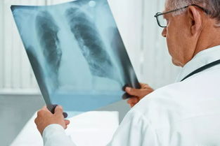 为什么出国要做肺结核检查-留学之前为什么只需要做肺结核体检